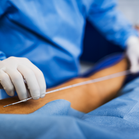 Celon bei Kröner Medizintechnik GmbH